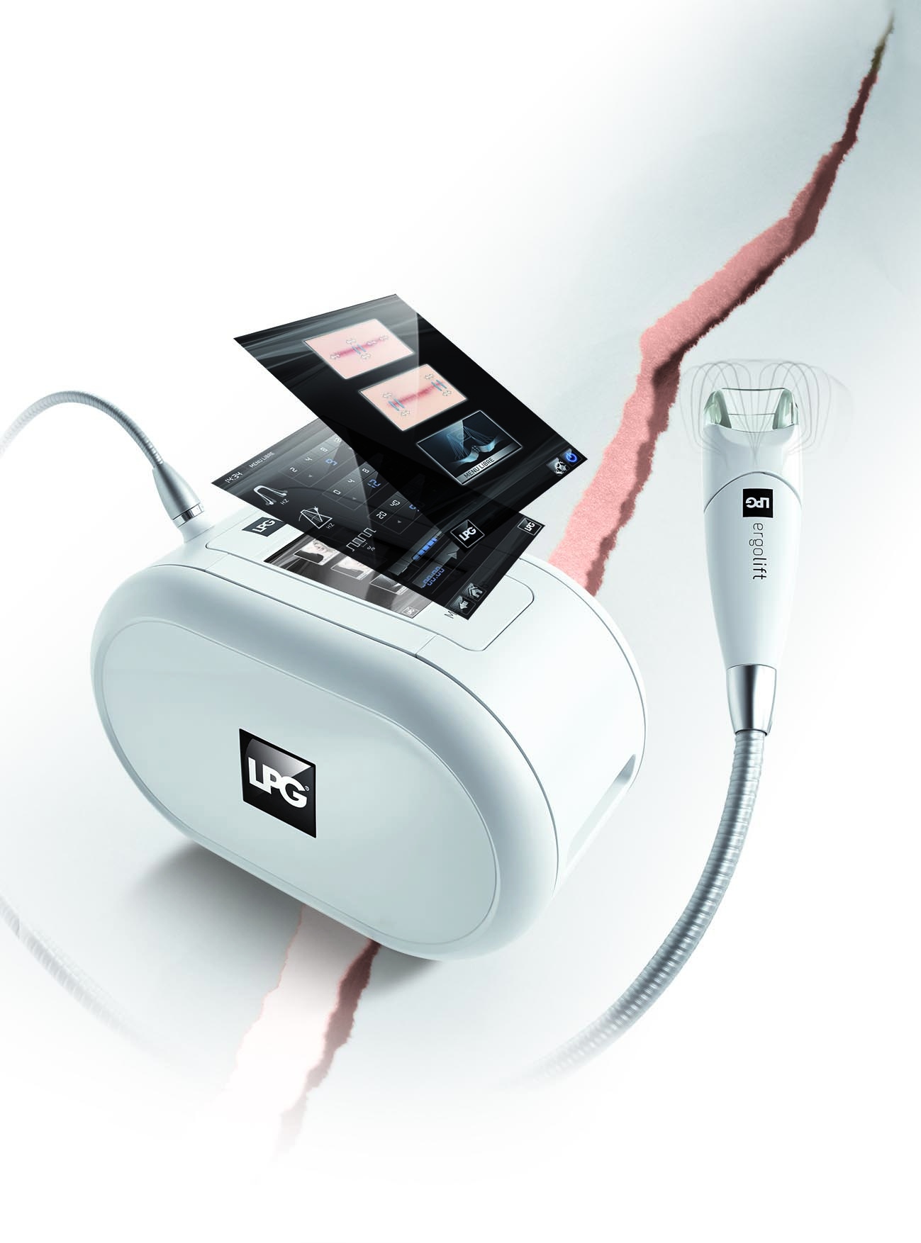 endermolift i oziljak-strija